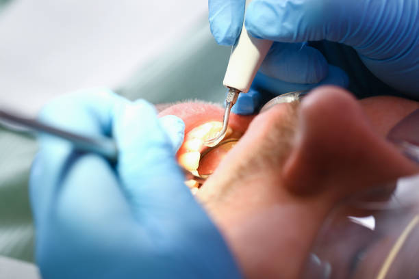 Best Cosmetic Emergency Dentistry in St Johns, MI