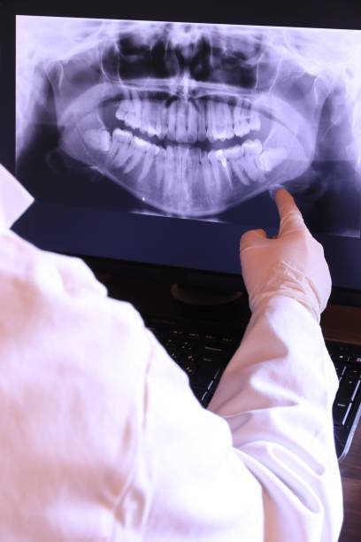 Best Emergency Tooth Extraction in St Johns, MI