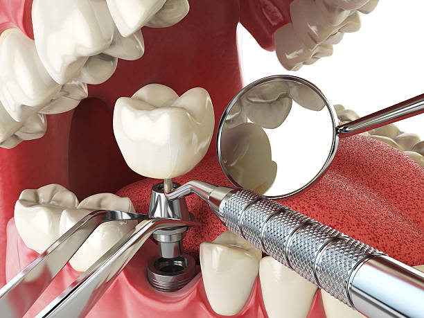 Best Weekend Emergency Dentist in St Johns, MI