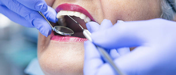 Best Emergency Treatment for Dental Infections or Abscesses in St Johns, MI